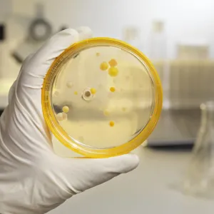 infectious diseases